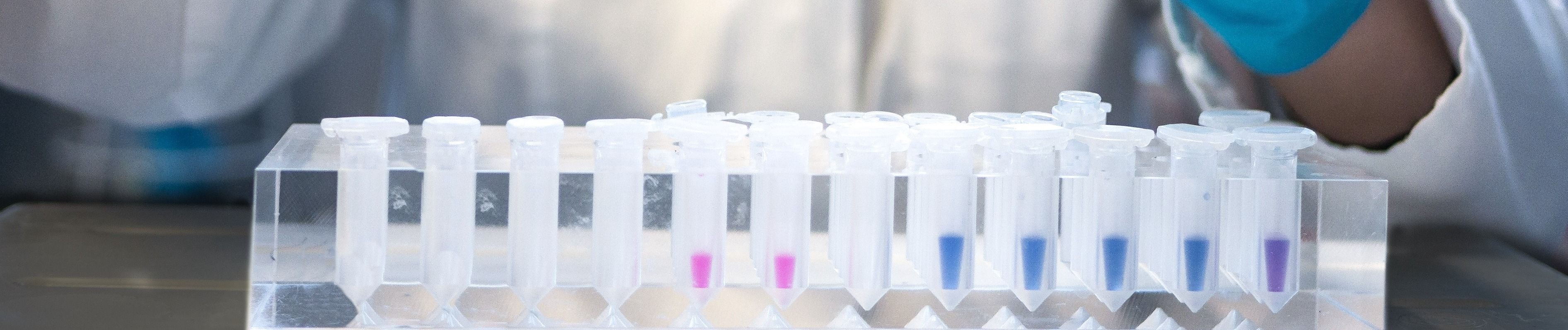You have probably heard the stories of people taking their science to industry or moving into the business side. We interviewed Dr. Yoram Barak, Global Product Manager of Chemicals at Applied Materials, to learn about his translational research.